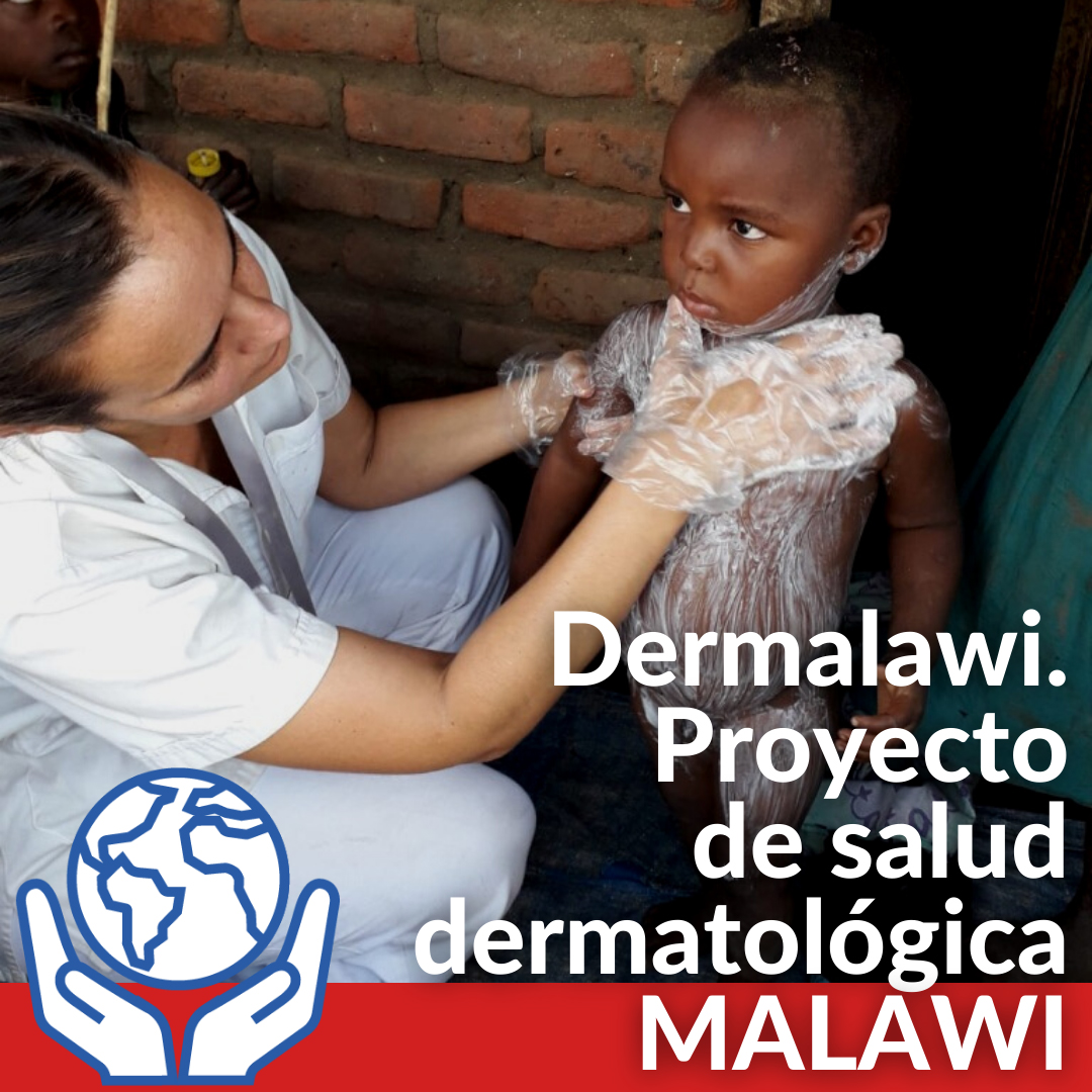 Proyecto en Malawi 2022